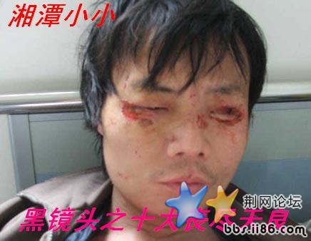 壮男被妻子用拴狗链锁家中长期虐待