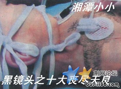 三岁男童遭刺青虐待 全身千疮百孔死亡