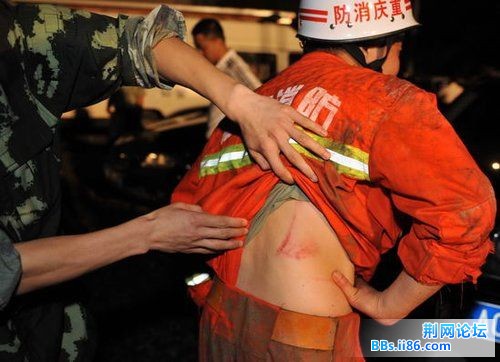 7月12日凌晨，搜救人员在察看战友被山石划破的伤口。