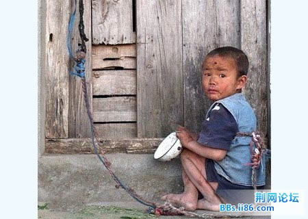 不久，民政局的相关人员也到达了。我们一起给孩子换上衣服，出发去医院 。